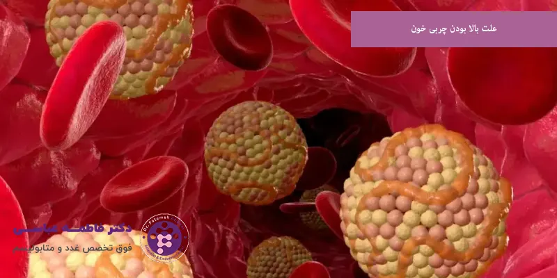 علت بالا بودن چربی خون