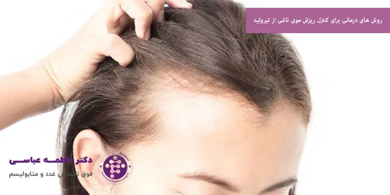 روش‌ های درمانی برای کنترل ریزش موی ناشی از تیروئید