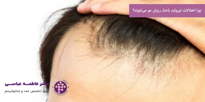 چرا اختلالات تیروئید باعث ریزش مو می‌شوند؟