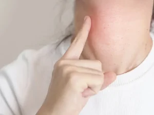 درمان تیروئید