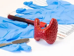 عمل تیروئید به چه صورت است